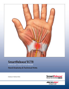 SmartRelease ECTR Technical Hints
